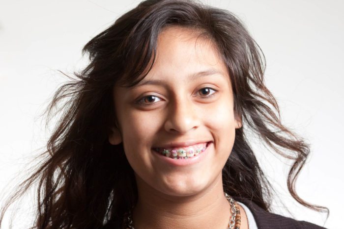 young teen smiling with braces from our Timonium orthodontist 