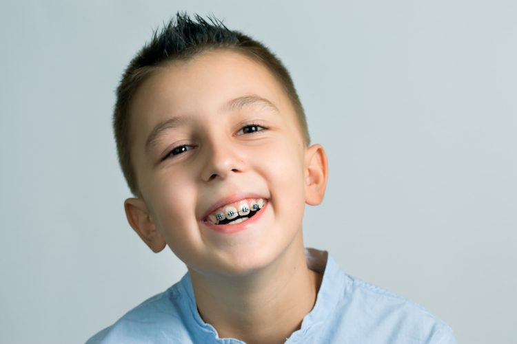 child wearing braces in timonium md orthodontist office