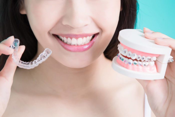 woman holding clear and traditional braces timonium md orthodontist