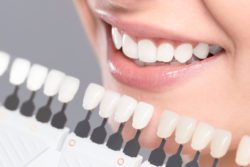 teeth whitening timonium md