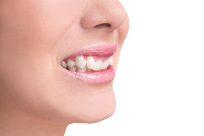 Why Are My Teeth Shifting After Braces?