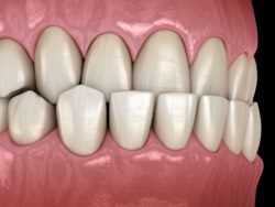orthodontist in lutherville, md