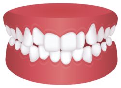 orthodontist in cockeysville, maryland