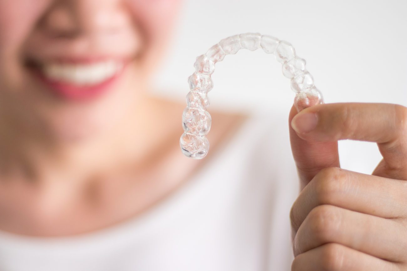 Clear aligners in Timonium MD