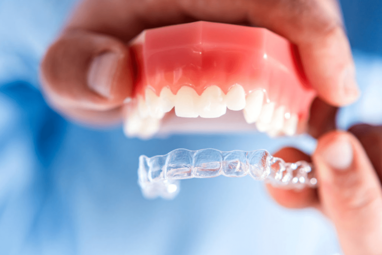 Clear aligners in Timonium