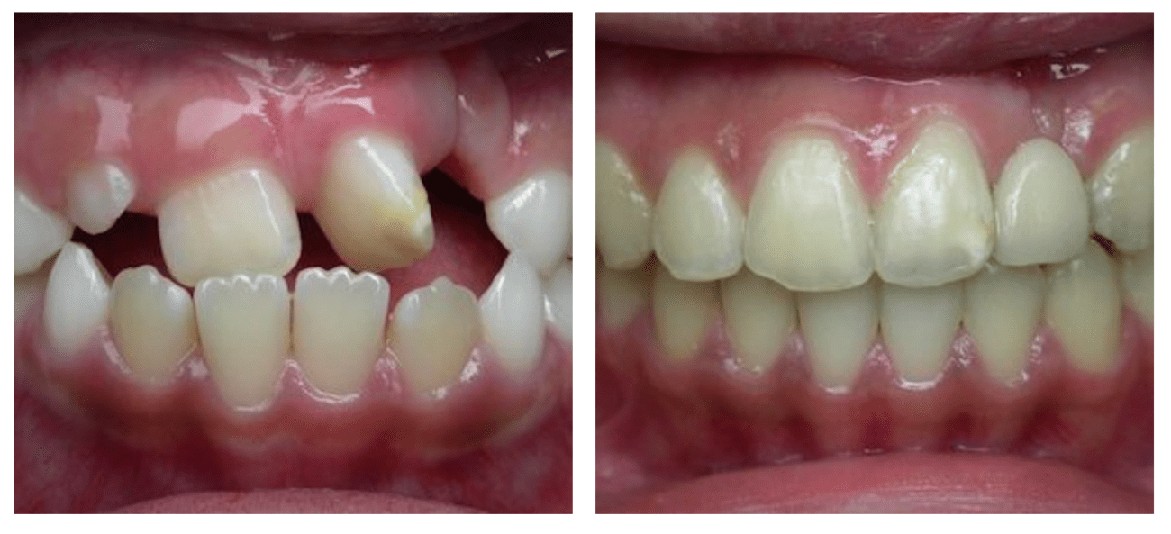 Orthodontic correction Timonium, MD