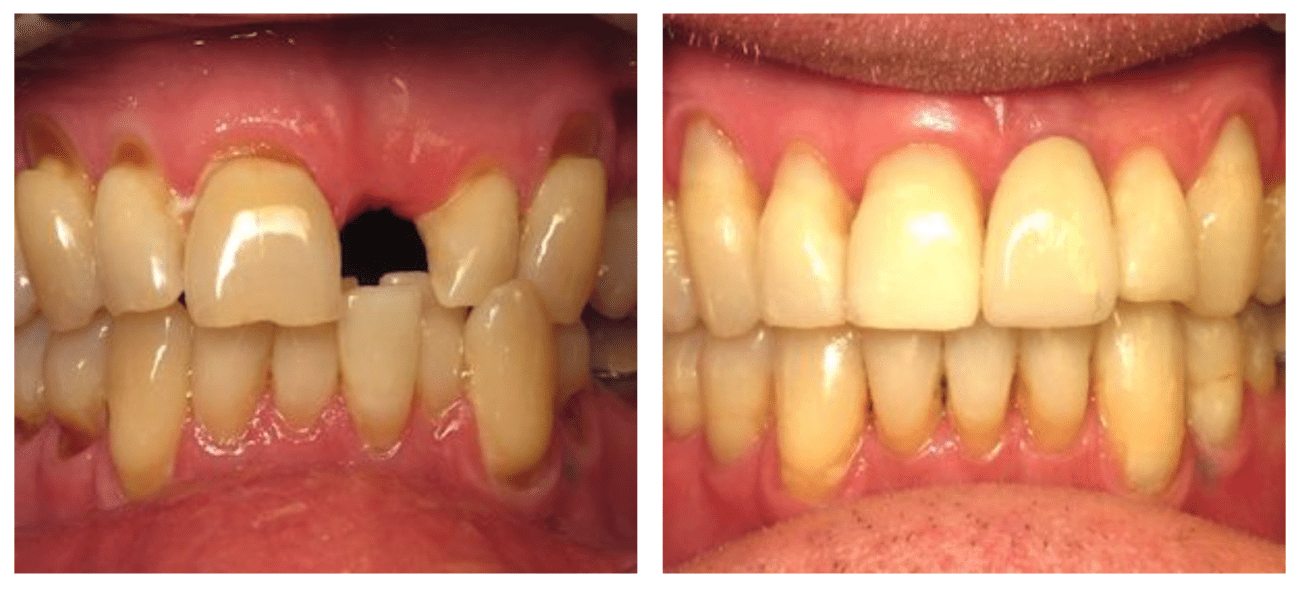 Adult orthodontist Timonium, MD