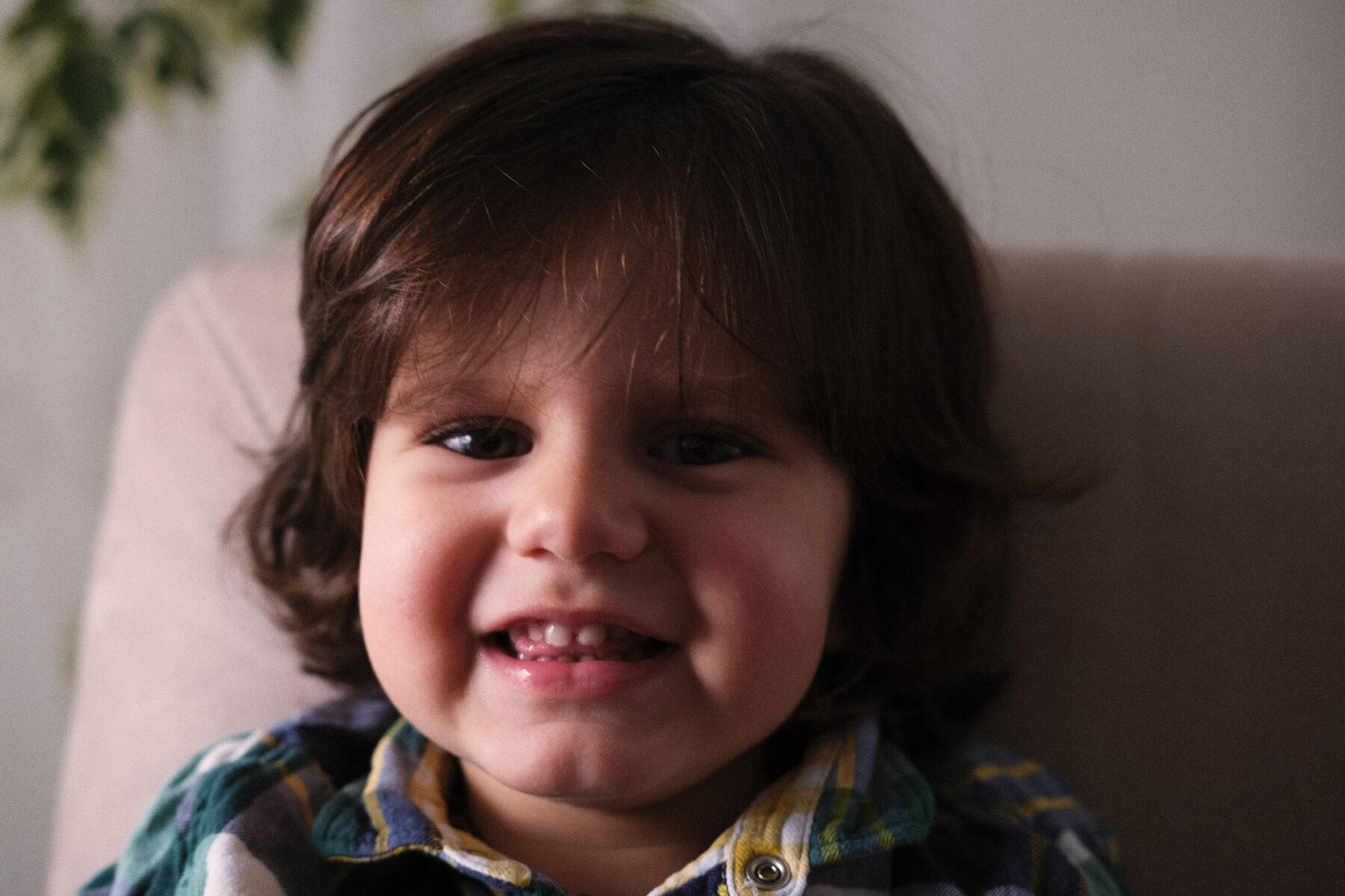Cleft palate treatments